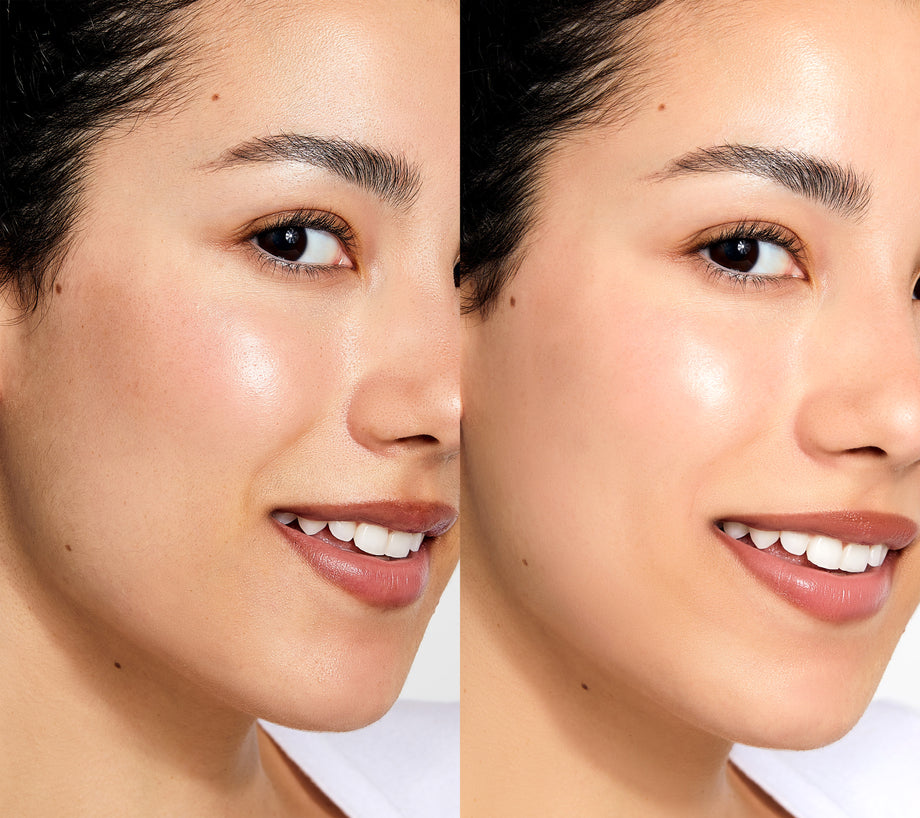 Contours Rx Dermal Blades (3-Pack)