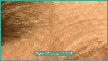 Contours Rx Microcrystal Patches (Set Of 4 Patches)