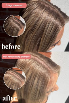 Vani-T Aeroclean Dry Shampoo with Hair Growth Complex