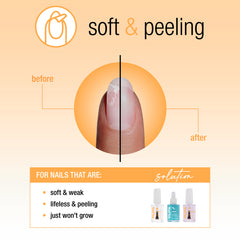 Nail Tek Nail Recovery For Soft Peeling Nails 3pc Kit