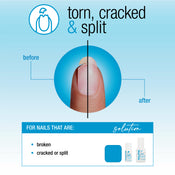 Nail Tek Nail Repair For Torn, Cracked Or Split Nails 2pc Kit