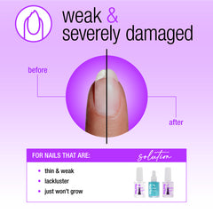 Nail Tek Nail Rescue For Weak Severely Damaged Nails 3pc Kit