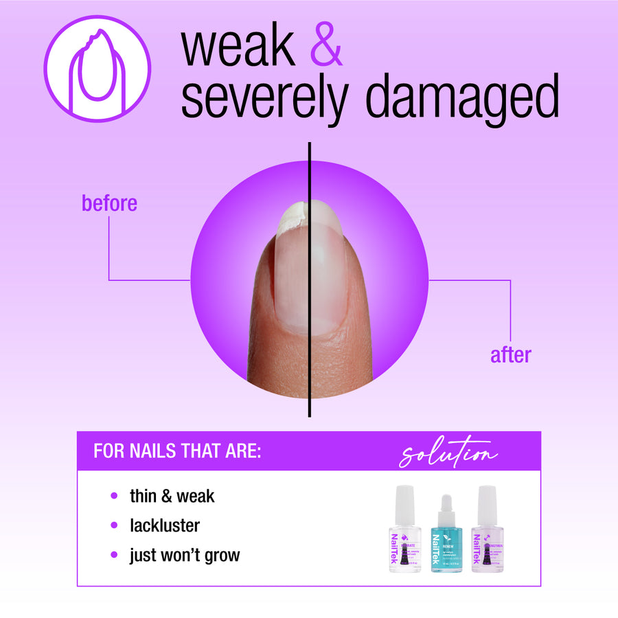 Nail Tek Nail Rescue For Weak Severely Damaged Nails 3pc Kit