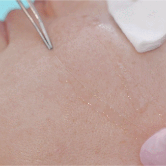 Donna+ Face Lifty Plus Set Professional